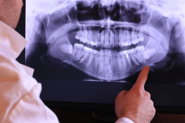 Best Broken or Cracked Tooth Emergency Dentist in Springdale, SC